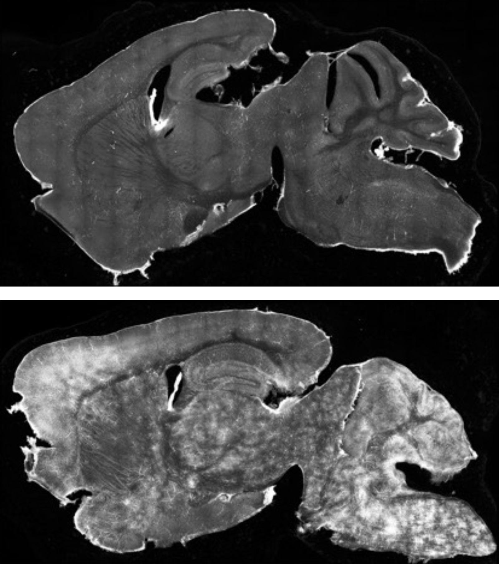 Mouse brain sections comparing atezolizumab delivered alone and with the BrainCAB molecular shuttle