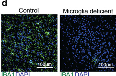 Selected immunofluorescence panels comparing control and microglia-deficient brain tissue